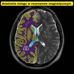 Image post by @neurochirurg_litak on Instagram