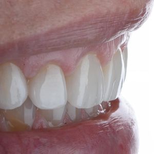 Image post by @sharpdentistry on Instagram