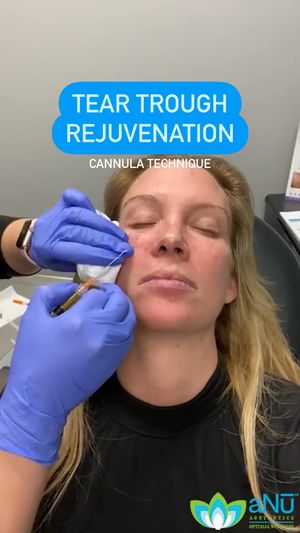Video post by @anuaestheticsandwellness on Instagram