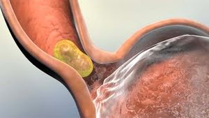 Video post by @nucleusmedicalmedia on YouTube