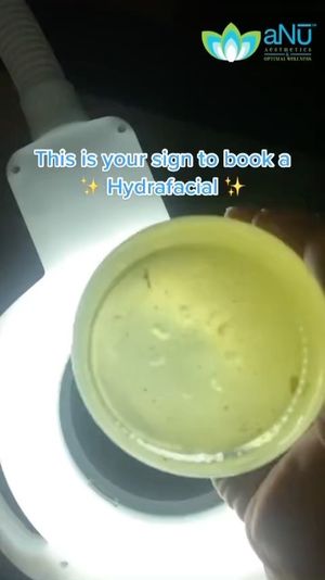 Video post by @anuaestheticsandwellness on Instagram
