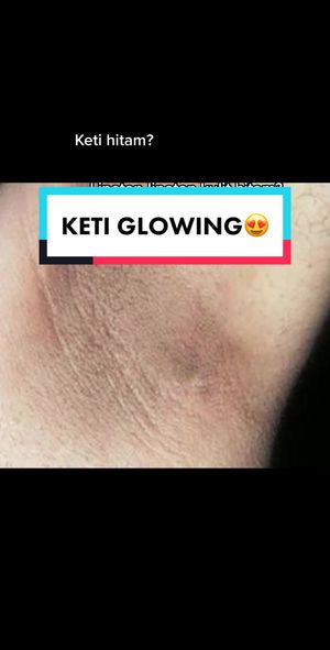 Video post by @lili.refliskin on TikTok
