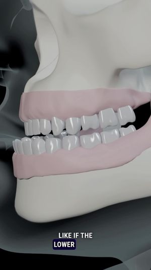 Video post by @dr.mehmetcomert on Instagram