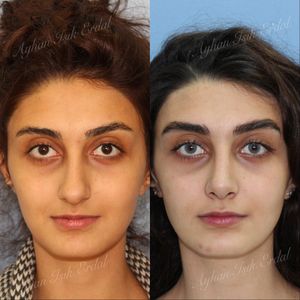 Image post by @dr.ayhanisikerdal on Instagram