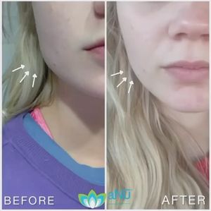 Video post by @anuaestheticsandwellness on Instagram