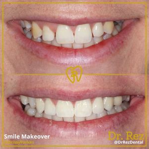 Image post by @drrezdental on Facebook