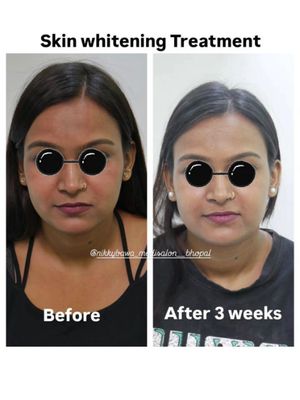 Image post by @nikkybawamedisalonbhopal on Instagram