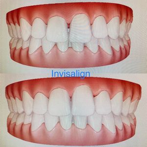 Image post by @sharpdentistry on Instagram