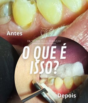 Image post by @dr.victorhugor on Instagram