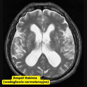 Image post by @neurochirurg_litak on Instagram
