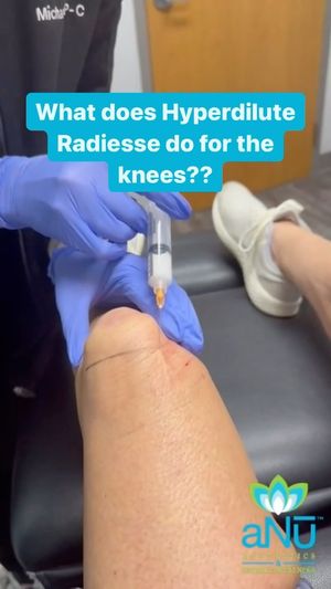 Video post by @anuaestheticsandwellness on Instagram