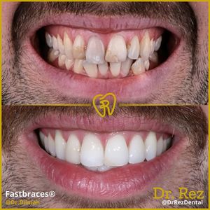 Image post by @drrezdental on Facebook