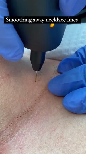 Video post by @anuaestheticsandwellness on Instagram