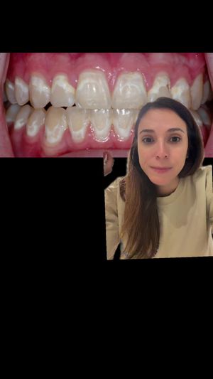 Video post by @weisstorortho on TikTok