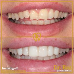 Image post by @drrezdental on Facebook