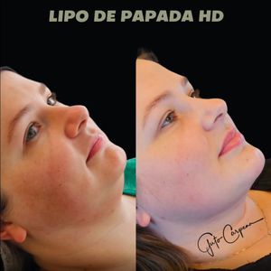 Image post by @drgutocarpena on Instagram