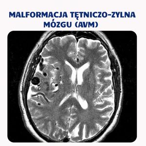 Image post by @neurochirurg_litak on Instagram