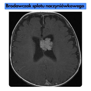 Image post by @neurochirurg_litak on Instagram