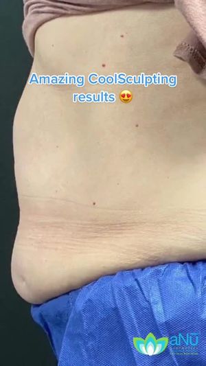 Video post by @anuaestheticsandwellness on Instagram