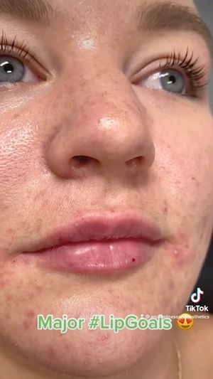 Video post by @anuaestheticsandwellness on Instagram