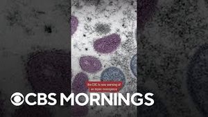 Video post by @cbsmornings on YouTube