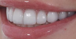 Image post by @sharpdentistry on Instagram