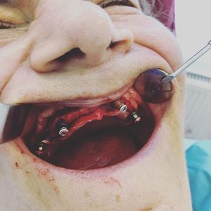 Image post by @dentamerzifon on Instagram