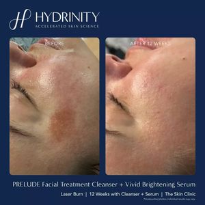 Image post by @hydrinity_skincare on Instagram