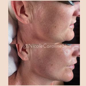 Image post by @nicolecarolineskin on Instagram