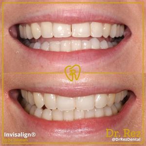 Image post by @drrezdental on Facebook