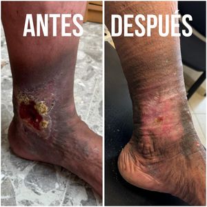Image post by @dr.vicentevascular on Instagram