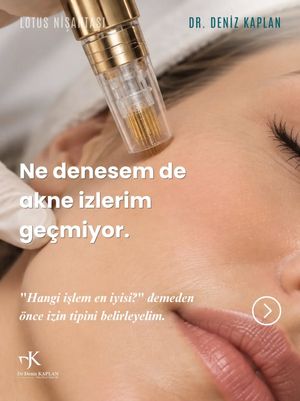 Image post by @dr.denizkaplan on Instagram