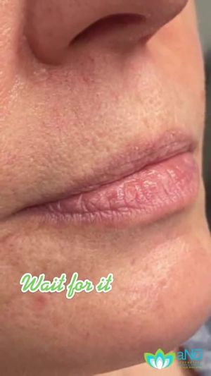 Video post by @anuaestheticsandwellness on Instagram