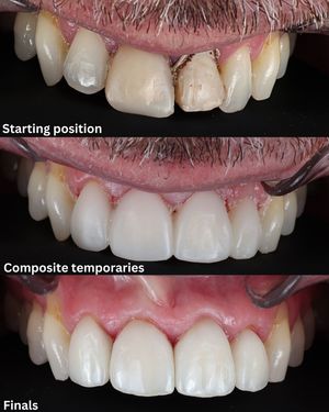 Image post by @fahaddentist on Instagram