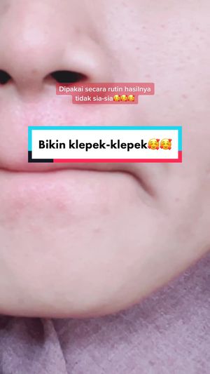 Video post by @lili.refliskin on TikTok