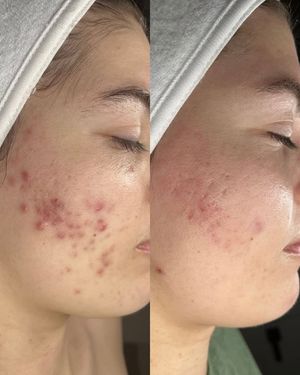 Image post by @HessBeautyBar on Facebook