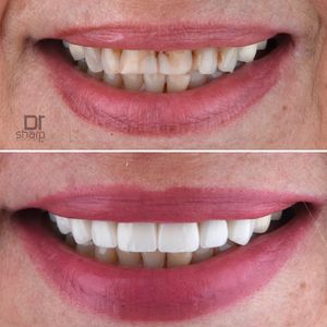 Image post by @sharpdentistry on Instagram