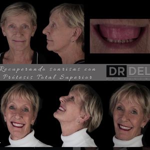Image post by @drdelfinbarquero on Instagram