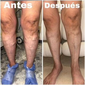 Image post by @dr.vicentevascular on Instagram