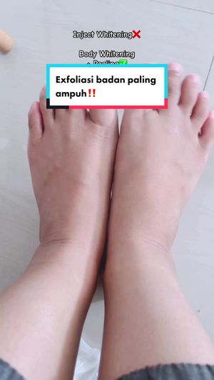 Video post by @lili.refliskin on TikTok