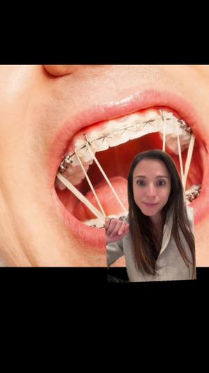 Video post by @weisstorortho on TikTok