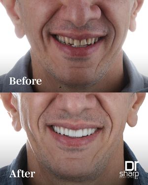 Image post by @sharpdentistry on Instagram