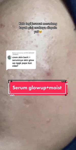 Video post by @lili.refliskin on TikTok