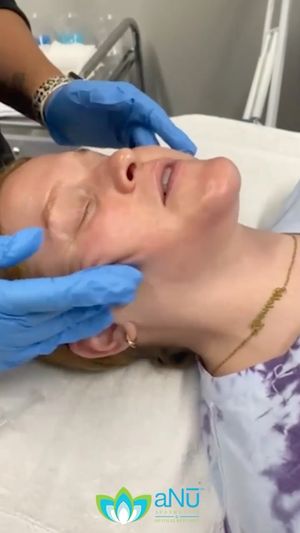 Video post by @anuaestheticsandwellness on Instagram