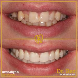 Image post by @drrezdental on Facebook