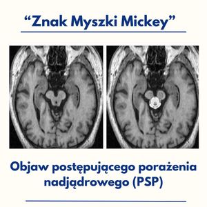Image post by @neurochirurg_litak on Instagram