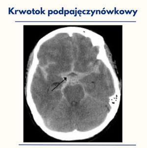 Image post by @neurochirurg_litak on Instagram