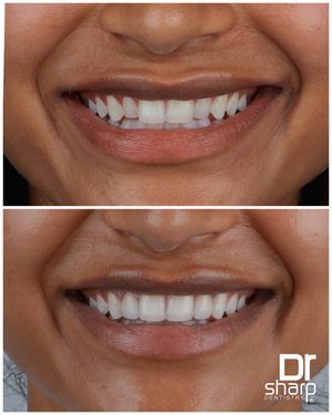 Image post by @sharpdentistry on Instagram