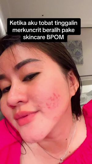 Video post by @lili.refliskin on TikTok
