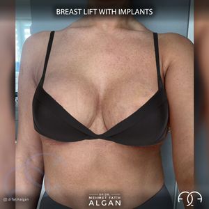 Image post by @drfatihalgan on Instagram